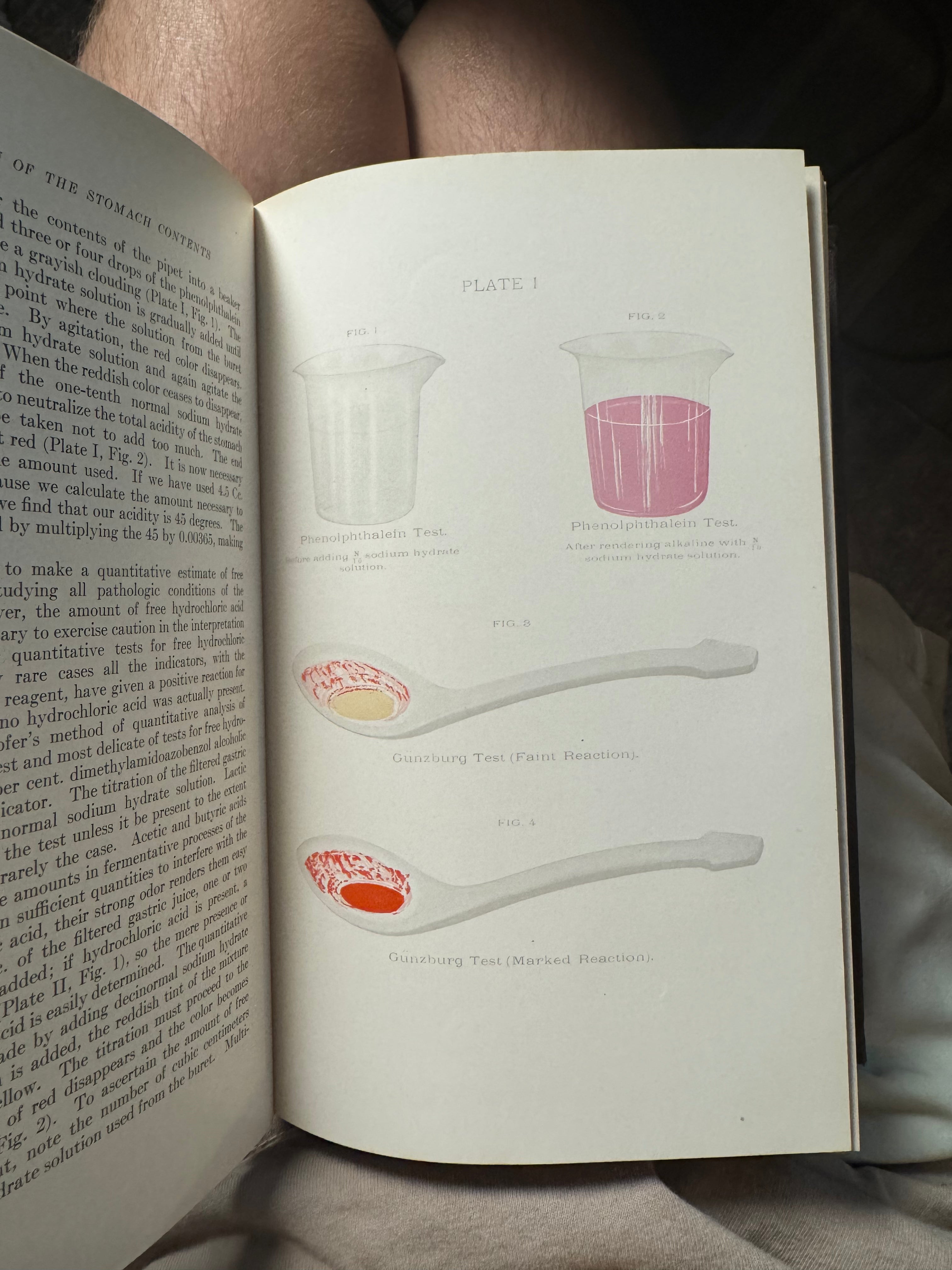 1915 1st Edition Medical Textbook (Digestive Organs) w/ Extras